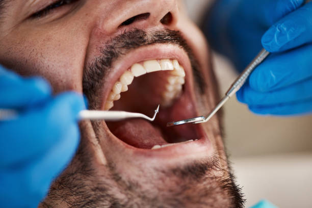 Best Emergency Treatment for Dental Infections or Abscesses in North Hornell, NY