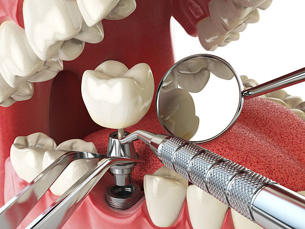 Best Emergency Denture Repair in North Hornell, NY